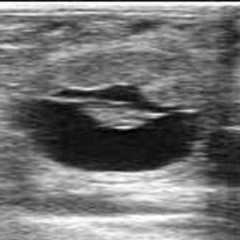 Reproduction ultrasound
